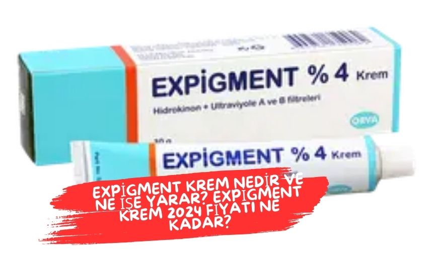 Expigment Krem Nedir ve Ne İşe Yarar? Expigment Krem 2024 Fiyatı Ne Kadar?